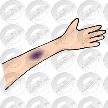 Bruise clipart #3, Download drawings