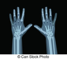 X-ray clipart #5, Download drawings