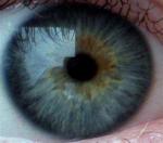 Heterochromia svg