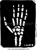 X-ray clipart